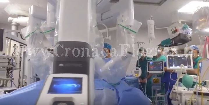 All’ospedale di Pozzuoli si opera col robot più avanzato al mondo – GUARDA IL VIDEO