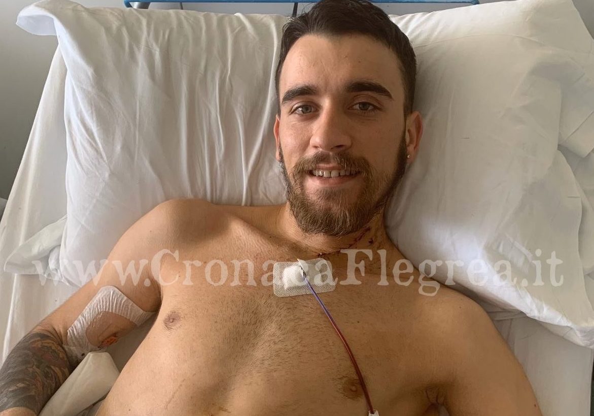 Raffaele, salvato a Pozzuoli dopo intervento flop in Australia: ricostruito l’esofago con un robot