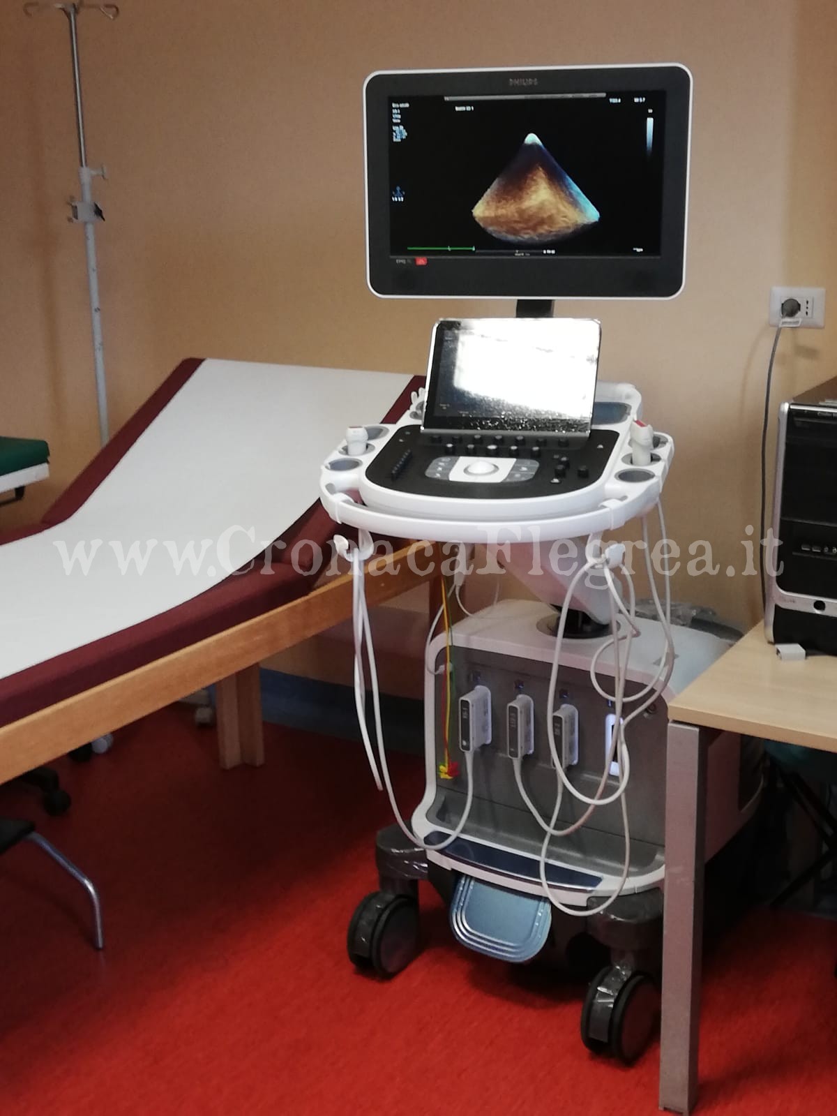 POZZUOLI/ Esami ecocardiografici in 3D in ospedale