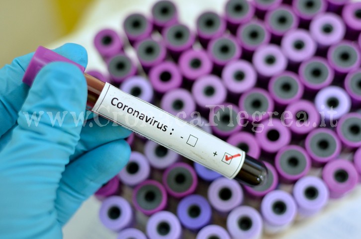Coronavirus: nuovi casi a Pozzuoli, Quarto e Bacoli