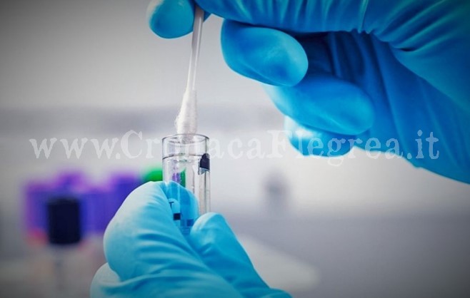 Coronavirus, 41 nuovi casi positivi e 11 guarigioni a Pozzuoli