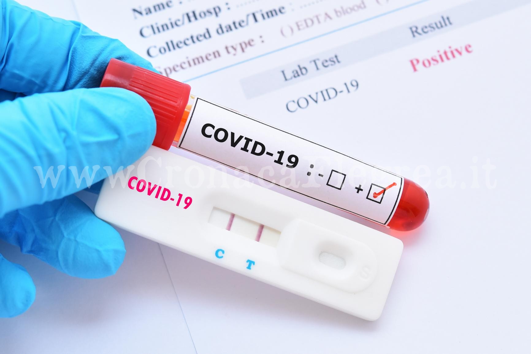Covid, aumentano i contagi: a Pozzuoli si sfiora quota 2000
