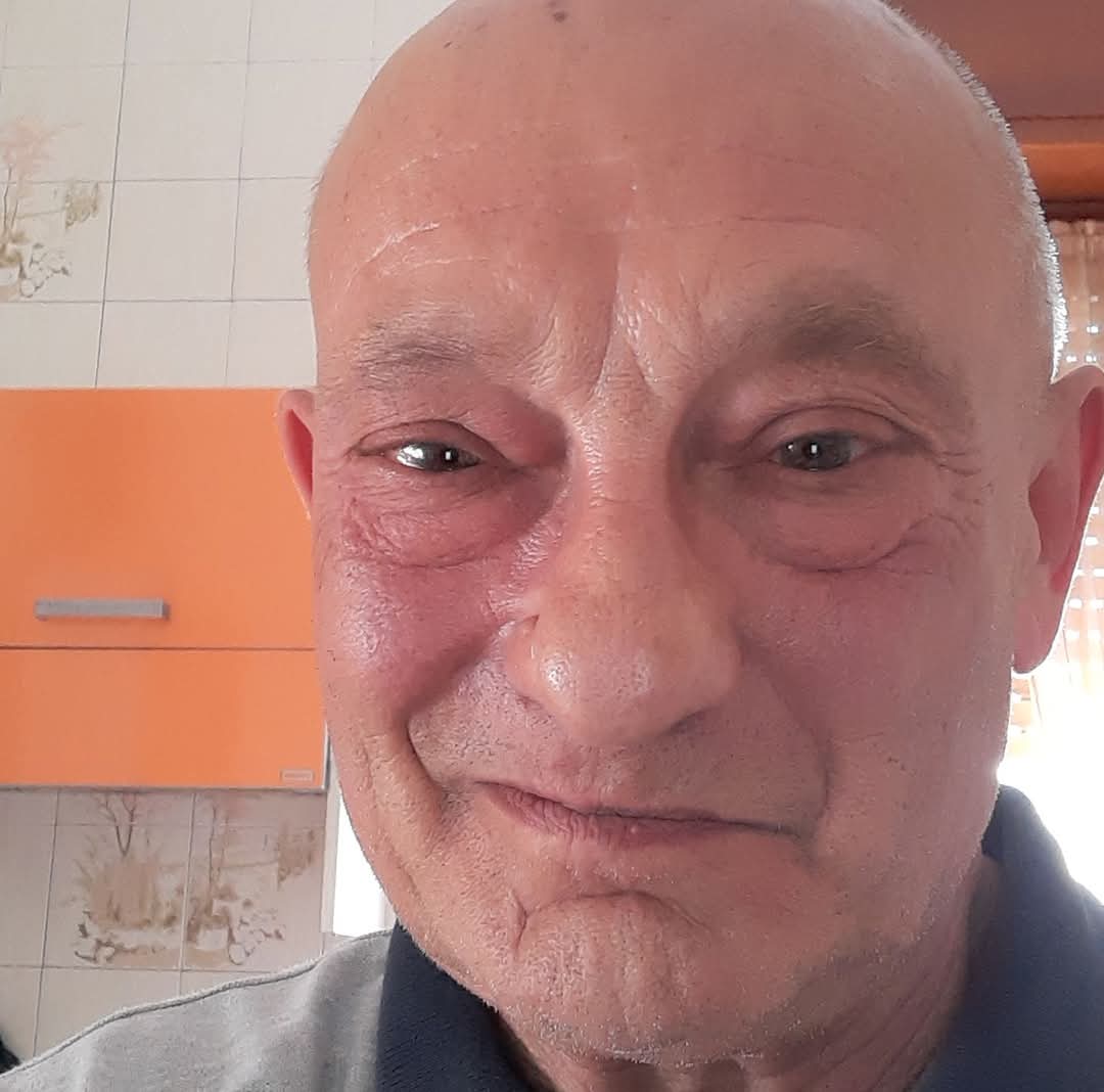Ucciso dai figli a Quarto, la psicologa: «Dipendenza economica patologica dal genitore e rifiuto del no»