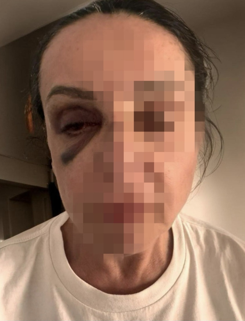 Donna perseguitata dal marito nonostante quattro denunce e il codice rosso