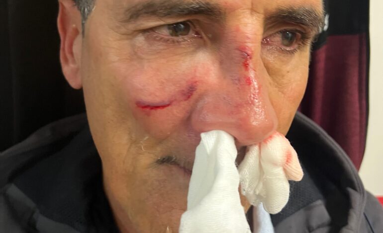 POZZUOLI/ Aggredito Gennaro Esposito, presidente del Campania Puteolana