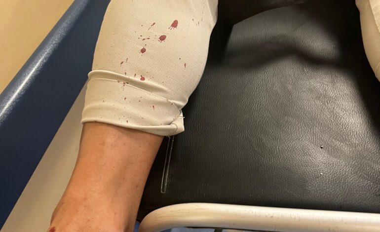 Aggressione ad Esposito, la condanna del sindaco di Torre del Greco «Gli autori vanno assicurati alla giustizia»