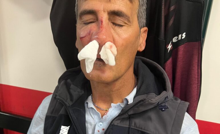 POZZUOLI/ Da Manzoni solidarietà ad Esposito «Grave ed inaccettabile aggressione»