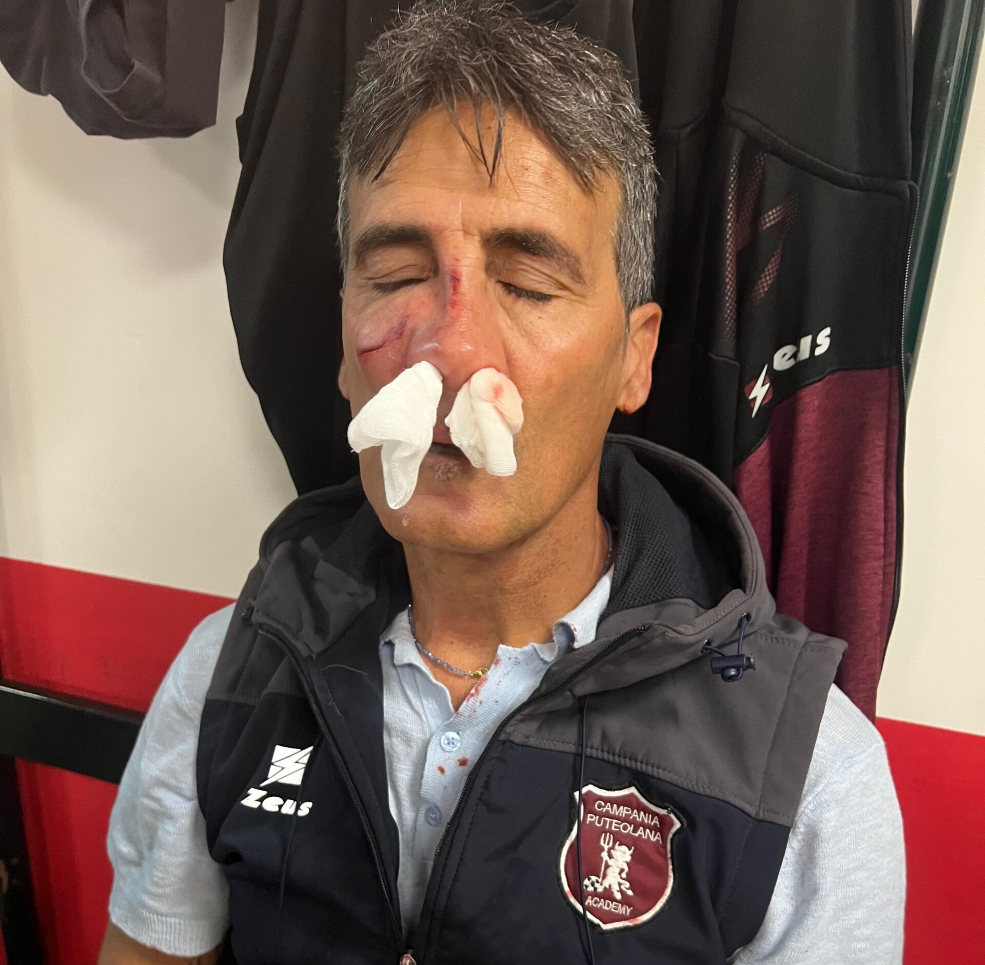 POZZUOLI/ Da Manzoni solidarietà ad Esposito «Grave ed inaccettabile aggressione»