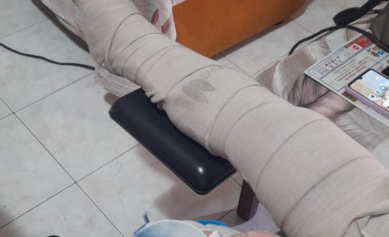 Anziana operata all’ospedale di Pozzuoli, ma il gesso non le viene tolto «Dovevano farlo entro 30 giorni»