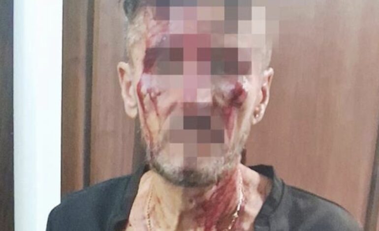 Choc a Bacoli, 60enne aggredito con una mazza di ferro dal nipote